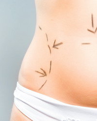 Cirug&iacute;a Pl&aacute;stica